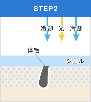 step2